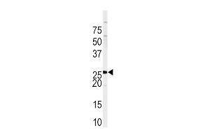 Western blot analysis of anti-SPRY4 Antibody (C-term) (ABIN391651 and ABIN2841559) in Sk-Br-3 cell line lysates (35 μg/lane). (SPRY4 antibody  (C-Term))
