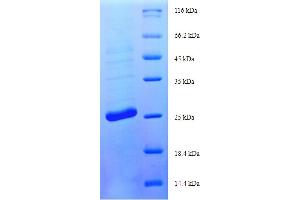 SDS-PAGE (SDS) image for Stimulator of Chondrogenesis 1 (SCRG1) (AA 21-98) protein (His-SUMO Tag) (ABIN4974926)
