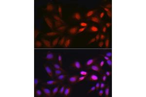 Immunofluorescence analysis of U2OS cells using EGR1 Rabbit pAb (ABIN3016527, ABIN3016528, ABIN3016529 and ABIN1679679) at dilution of 1:250 (40x lens). (EGR1 antibody)