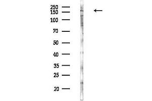 anti-Synaptonemal Complex Protein 2 (SYCP2) (Internal Region) antibody