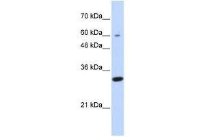 WB Suggested Anti-LRRC57 Antibody Titration: 0.