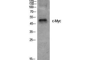 Western Blot (WB) analysis of specific cells using c-Myc Polyclonal Antibody. (c-MYC antibody  (Ser95))