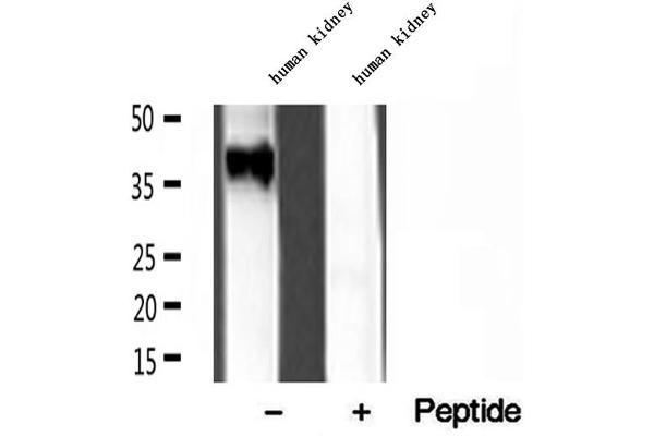 RDH10 antibody  (Internal Region)