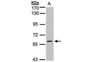 WB Image Sample(30 ug whole cell lysate) A:H1299 7. (MAPK4 antibody)