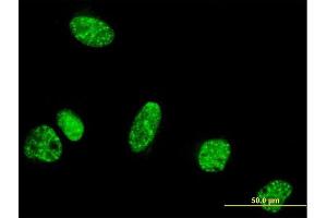 Immunofluorescence of monoclonal antibody to PPIG on HeLa cell. (PPIG antibody  (AA 13-106))