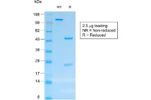 SDS-PAGE Analysis Purified CD30 Mouse Recombinant Monoclonal Antibody (rCD30/412). (Recombinant TNFRSF8 antibody)