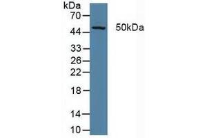Figure. (ERCC5 antibody  (AA 778-986))