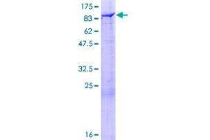 DSTYK Protein (AA 1-587) (GST tag)