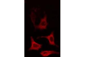 ABIN6274651 staining HT29 cells by IF/ICC. (CYP2R1 antibody  (Internal Region))