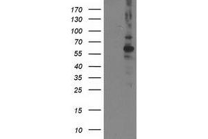 PPM1B antibody