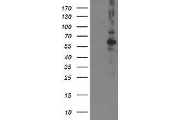 PPM1B antibody
