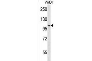 SDCCAG1 Antibody (N-term) (ABIN1539209 and ABIN2850179) western blot analysis in WiDr cell line lysates (35 μg/lane). (NEMF antibody  (N-Term))