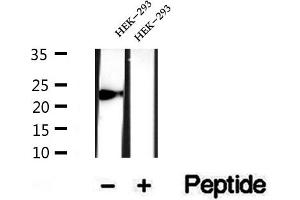 Western blot analysis of extracts of HEK-293 cells, using CYPC antibody. (PPIC antibody  (Internal Region))