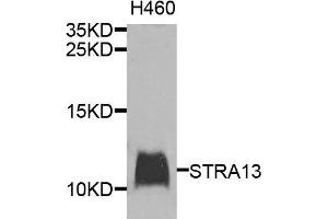 Western blot analysis of extracts of H460 cells, using STRA13 antibody.
