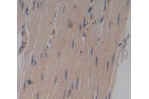 IHC-P analysis of Human Tissue, with DAB staining. (TNNT1 antibody  (AA 1-259))