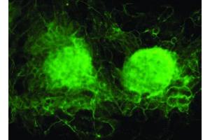 Image no. 3 for anti-Vezatin, Adherens Junctions Transmembrane Protein (VEZT) antibody (ABIN347059) (VEZT antibody)