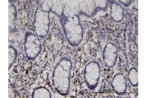 Immunoperoxidase of monoclonal antibody to NME6 on formalin-fixed paraffin-embedded human small Intestine. (NME6 antibody  (AA 1-194))