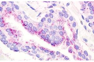 Image no. 1 for anti-G Protein-Coupled Receptor 21 (GPR21) (Transmembrane Domain) antibody (ABIN1048778) (GPR21 antibody  (Transmembrane Domain))