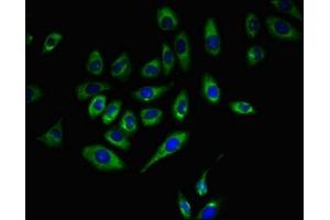 Immunofluorescent analysis of A549 cells using ABIN7171399 at dilution of 1:100 and Alexa Fluor 488-congugated AffiniPure Goat Anti-Rabbit IgG(H+L) (CD5 antibody  (AA 28-234))