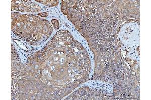 IHC analysis of YWHAE using anti-YWHAE antibody (ABIN7599165). (YWHAE antibody  (AA 1-255))