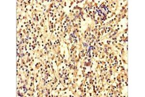 Immunohistochemistry of paraffin-embedded human spleen tissue using ABIN7144155 at dilution of 1:100 (ANKDD1A antibody  (AA 272-490))