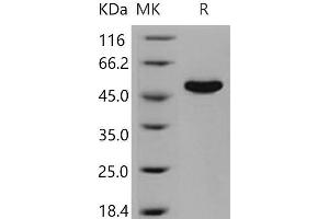 Western Blotting (WB) image for CNDP Dipeptidase 2 (Metallopeptidase M20 Family) (CNDP2) (Active) protein (His tag) (ABIN7320351) (CNDP2 Protein (His tag))