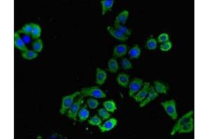 Immunofluorescence (IF) image for anti-Solute Carrier Family 16, Member 9 (Monocarboxylic Acid Transporter 9) (SLC16A9) (AA 185-304) antibody (ABIN7160177)