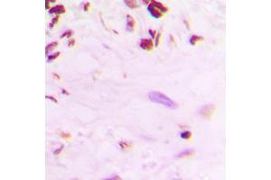 Immunohistochemistry (IHC) image for anti-Tumor Protein P53 (TP53) (C-Term), (pSer392) antibody (ABIN7301398)