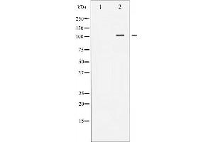 Western blot analysis of FAK expression in NIH-3T3 whole cell lysates,The lane on the left is treated with the antigen-specific peptide. (FAK antibody  (Internal Region))