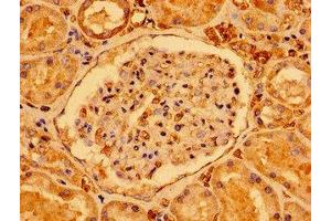 Immunohistochemistry of paraffin-embedded human kidney tissue using ABIN7170894 at dilution of 1:100 (SDHAF1 antibody  (AA 78-115))