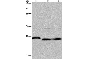 Western blot analysis of Human placenta tissue, HT-29 cell and human fetal brain tissue, using GSTP1 Polyclonal Antibody at dilution of 1:300 (GSTP1 antibody)