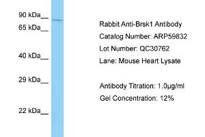 Western Blotting (WB) image for anti-BR Serine/threonine Kinase 1 (BRSK1) (C-Term) antibody (ABIN2788234) (BRSK1 antibody  (C-Term))