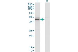 Western Blot analysis of TARBP2 expression in transfected 293T cell line by TARBP2 monoclonal antibody (M04), clone 2G10. (TARBP2 antibody  (AA 141-250))