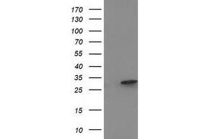HEK293T cells were transfected with the pCMV6-ENTRY control (Left lane) or pCMV6-ENTRY EIF4E2 (Right lane) cDNA for 48 hrs and lysed. (EIF4E2 antibody)