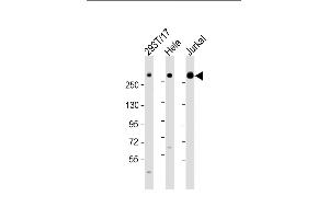 All lanes : Anti-IGF2R Antibody (C-Term) at 1:2000 dilution Lane 1: 293T/17 whole cell lysate Lane 2: Hela whole cell lysate Lane 3: Jurkat whole cell lysate Lysates/proteins at 20 μg per lane. (IGF2R antibody  (AA 2424-2458))