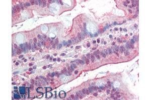 ABIN1590010 (5µg/ml) staining of paraffin embedded Human Small Intestine. (DGAT1 antibody  (AA 67-79))