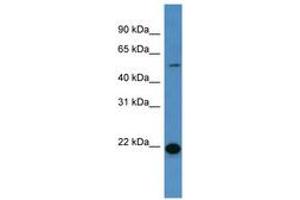 Image no. 1 for anti-Carcinoembryonic Antigen-Related Cell Adhesion Molecule 3 (CEACAM3) (AA 177-226) antibody (ABIN6746759) (CEACAM3 antibody  (AA 177-226))