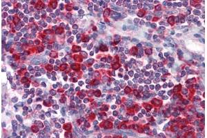 Human Tonsil: Formalin-Fixed, Paraffin-Embedded (FFPE) (MTDH antibody)