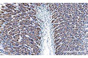IHC analysis of Tspan1 using anti-Tspan1 antibody (ABIN7599878). (TSPAN1 antibody  (AA 125-212))