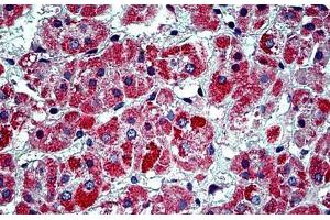 Human Adrenal: Formalin-Fixed, Paraffin-Embedded (FFPE) (Prohibitin 2 antibody  (Tyr128))