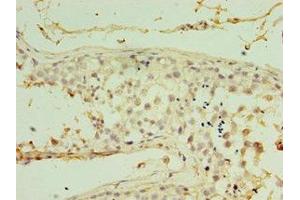 Immunohistochemistry of paraffin-embedded human testis tissue using ABIN7167041 at dilution of 1:100 (RDM1 antibody  (AA 125-284))
