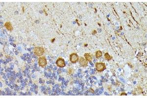 Immunohistochemistry of paraffin-embedded Mouse cerebellum using ELP3 Polyclonal Antibody at dilution of 1:100 (40x lens). (ELP3/KAT9 antibody)