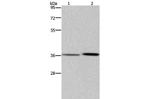 Western Blot analysis of A549 cell and Human fetal liver tissue using MAGEF1 Polyclonal Antibody at dilution of 1:300 (MAGEF1 antibody)