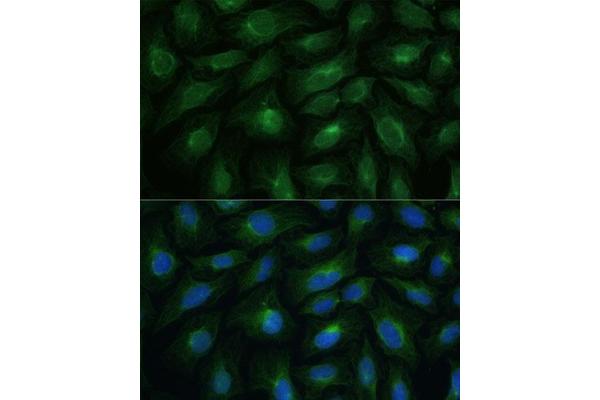 Cyclin M1 antibody  (AA 692-951)