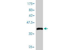 Western Blot detection against Immunogen (38. (MSMB antibody  (AA 1-114))