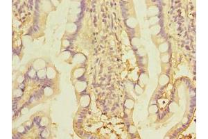 Immunohistochemistry of paraffin-embedded human small intestine tissue using ABIN7171988 at dilution of 1:100 (THTPA antibody  (AA 2-230))