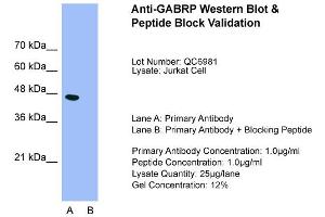 Host:  Rabbit  Target Name:  GABRP  Sample Type:  Jurkat  Lane A:  Primary Antibody  Lane B:  Primary Antibody + Blocking Peptide  Primary Antibody Concentration:  1. (GABRP antibody  (N-Term))