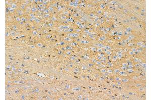 ABIN6263073 and ABIN6272517 at 1/100 staining Rat brain tissue by IHC-P.