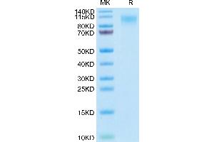 MERTK Protein (AA 21-505) (His tag)