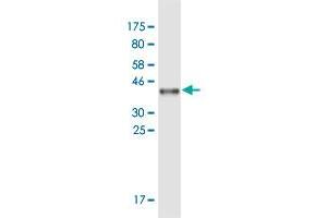 Western Blot detection against Immunogen (36. (APOB antibody  (AA 28-127))